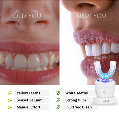 NexBrush Toothbrush™